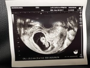 妖精のようなかわいいわが子の隣に移る出血痕(画像右)